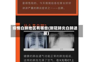 疫情白肺地区有哪些(新冠肺炎白肺进展)