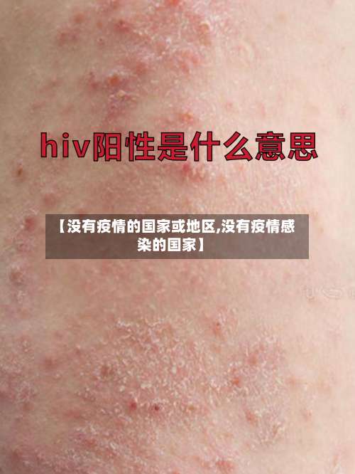 【没有疫情的国家或地区,没有疫情感染的国家】-第1张图片