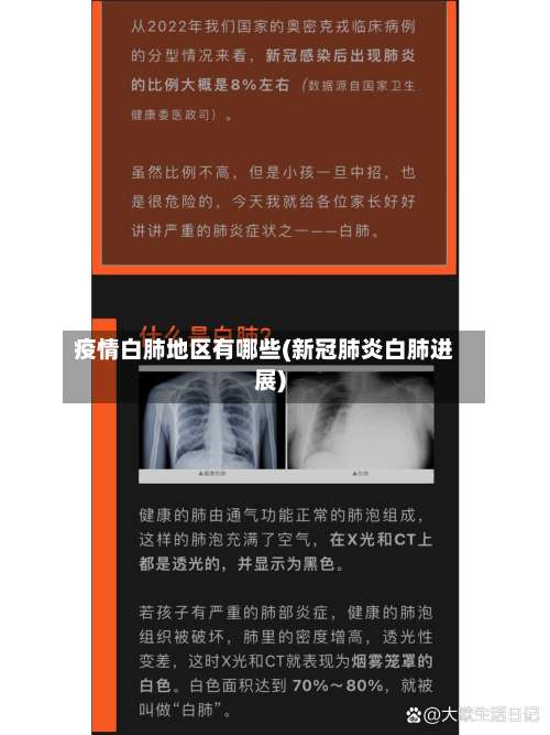 疫情白肺地区有哪些(新冠肺炎白肺进展)-第1张图片