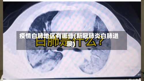 疫情白肺地区有哪些(新冠肺炎白肺进展)-第2张图片