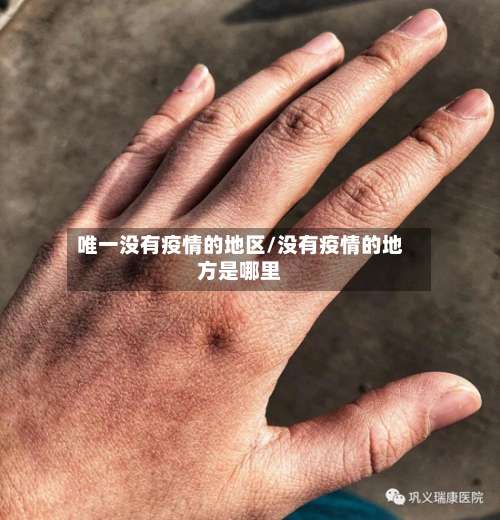 唯一没有疫情的地区/没有疫情的地方是哪里-第3张图片